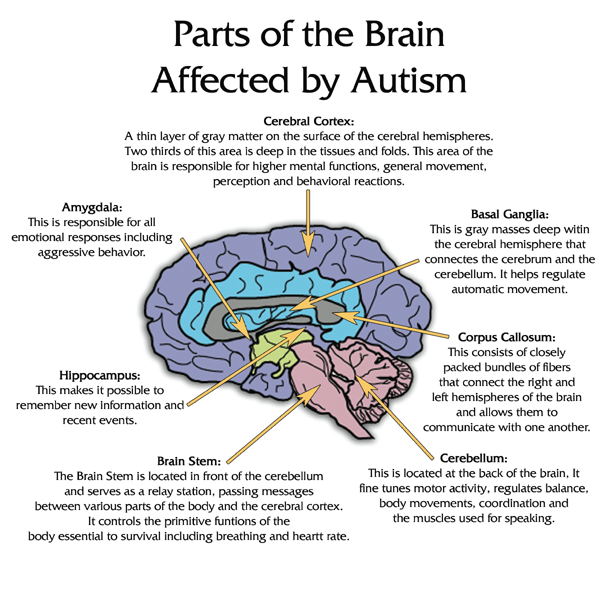aspergers syndrome brain compared to normal brain