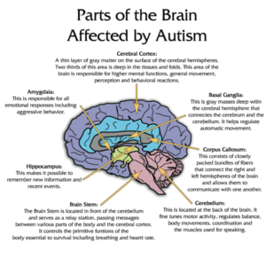 brain_autism